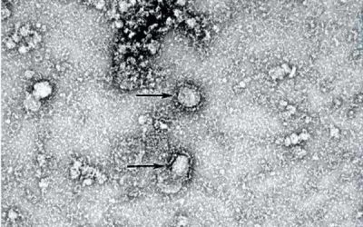 2 muertos y 231 contagiados por coronavirus en Colombia